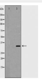 Cyclin D2 Antibody