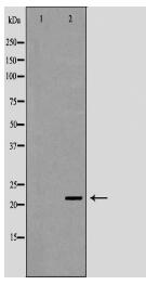 UBE2K Antibody