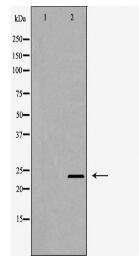 PSMD10 Antibody