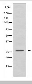 OR7E5P Antibody