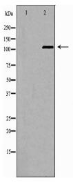 PTK2 Antibody