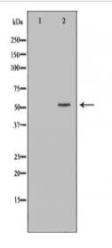 MDM2 Antibody