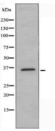 TAS2R39 Antibody