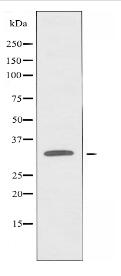 ZNF265 Antibody