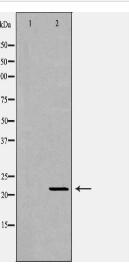 IFN-α Antibody