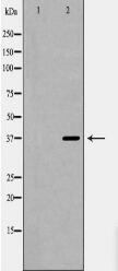 SORD Antibody