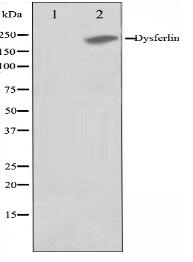 Dysferlin Antibody