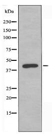 PRLHR Antibody