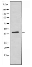LMTK3 Antibody