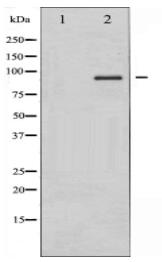 IKK-alpha/beta Antibody