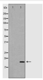 TNNC1 Antibody