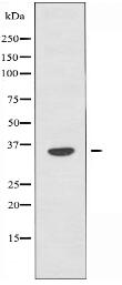 OR6A2 Antibody