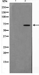 PIAS3 Antibody