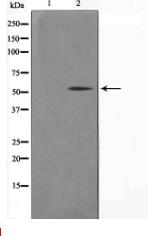 Keratin 14 Antibody