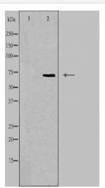 SCNN1D Antibody