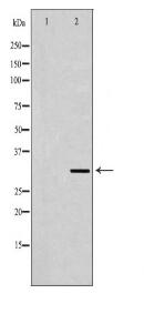 TPM2 Antibody