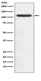 HIP1 Antibody