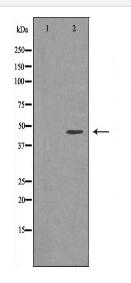 RRM2 Antibody