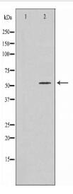 TBX22 Antibody