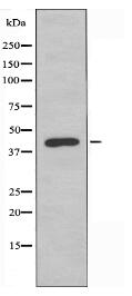 TBX10 Antibody