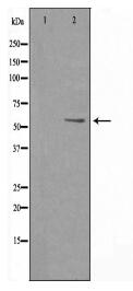 PFKFB2 Antibody