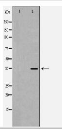 PPP1CB Antibody