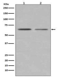 ER alpha Antibody