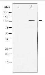 Androgen Receptor Antibody
