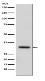 C10orf63 Antibody