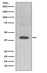 TRAM2 Antibody