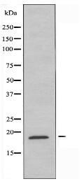 RPS11 Antibody