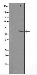 PPP1R16A Antibody