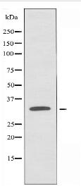 OR2T1 Antibody