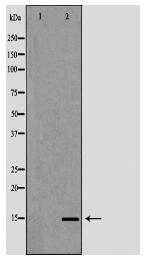 KCNE1 Antibody