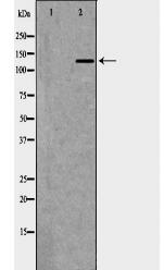 NPHS1 Antibody