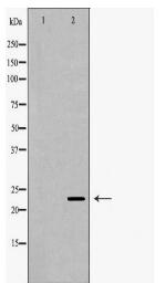 ICOS Antibody