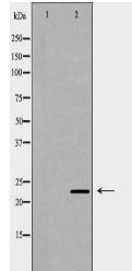 PSMB9 Antibody