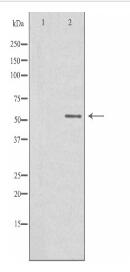 STK32C Antibody