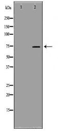 SCNN1B Antibody