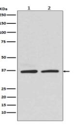 Rad51 Antibody