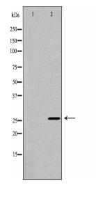 TNF Antibody