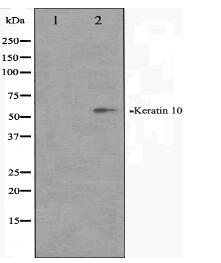 Keratin 10 Antibody