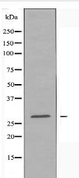 RAB20 Antibody