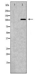 TNK2 Antibody