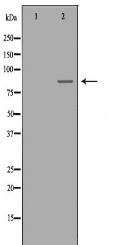 PRKCE Antibody