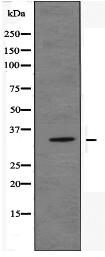 OR51E1 Antibody