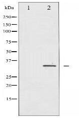 IGFBP-3 Antibody