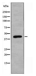 ZADH2 Antibody