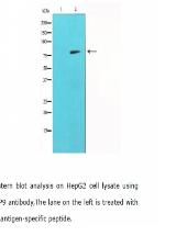 MMP-9 Antibody