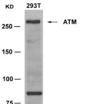 ATM Antibody